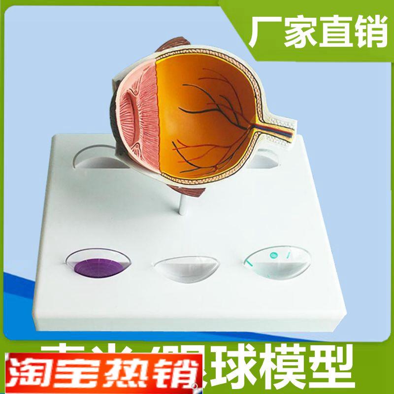 病理眼球模型青光白内角膜受损眼睛结G构可拆卸视网膜眼底检查神