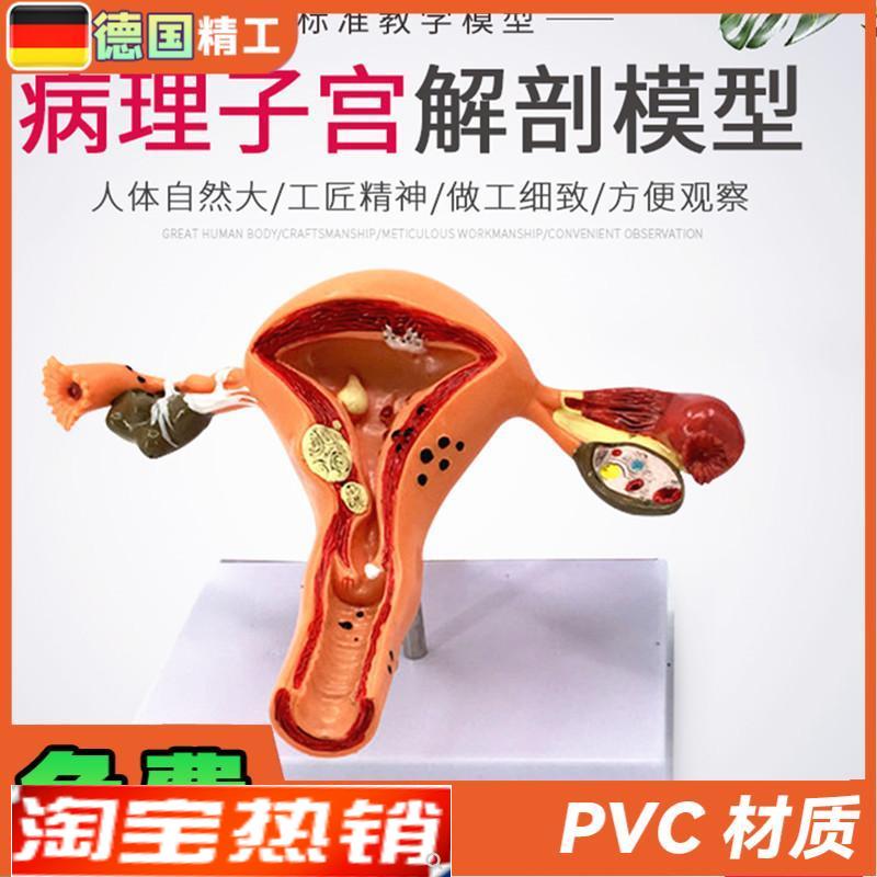 女性大子宫模型放大模型女性生殖解剖模O型计划生育示教模型