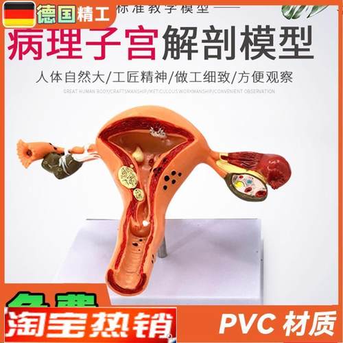 女性大子宫模型放大模型女性生殖解剖模O型计划生育示教模型