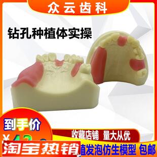 牙科上颌窦提升操练模型种w植牙练习模型口腔种植软牙龈齿科材料