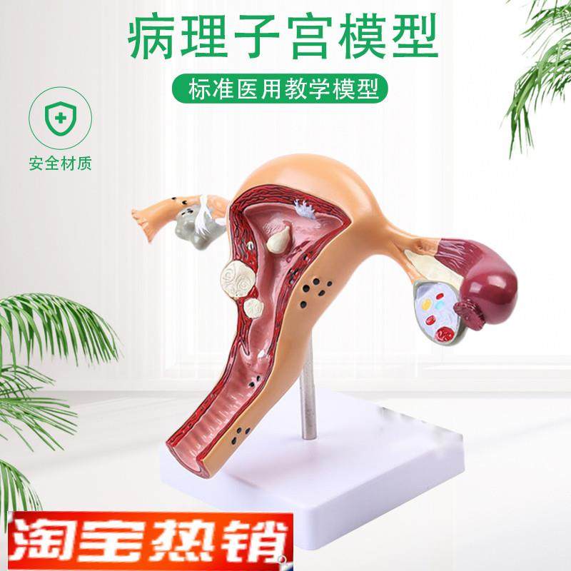 人体模型女性生殖子宫阴道v卵巢子宫教学模具病理变化科普培训教