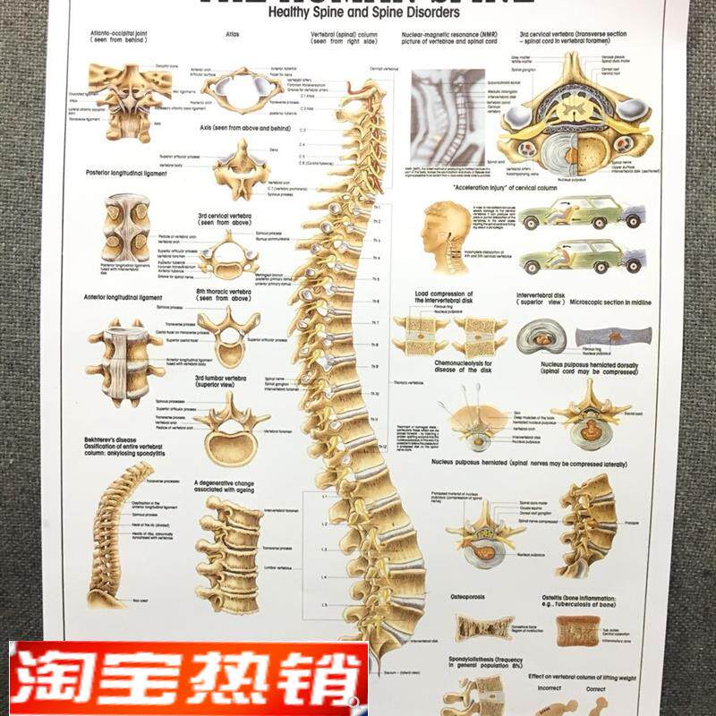 医院人体解f剖图挂图人体器官结构图人体脊柱脊椎骨颈椎图挂图
