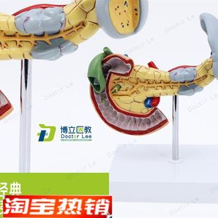 消化胰脏病变胰脾胆十q二指肠模型进口模型人体病变内脏解剖模型