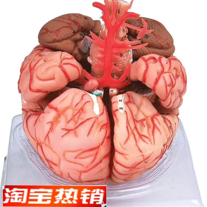脑动脉模b型GD/A18220