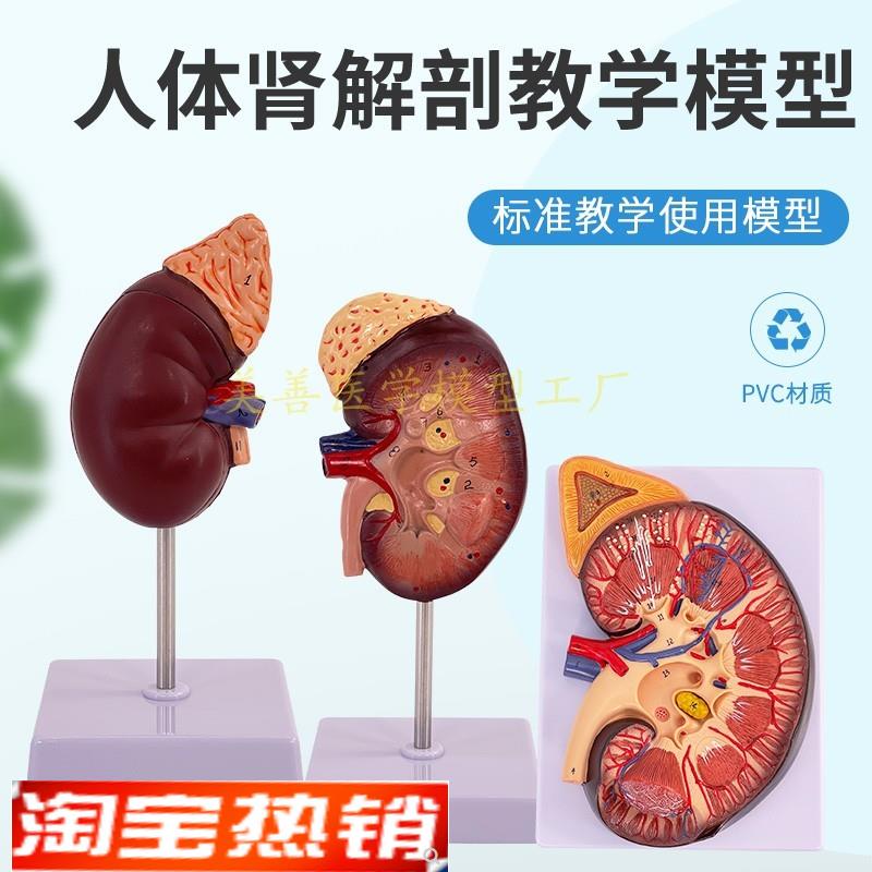 人体肾脏b模型肾解剖附肾上腺放大模型病变肾脏内脏器官解剖3倍