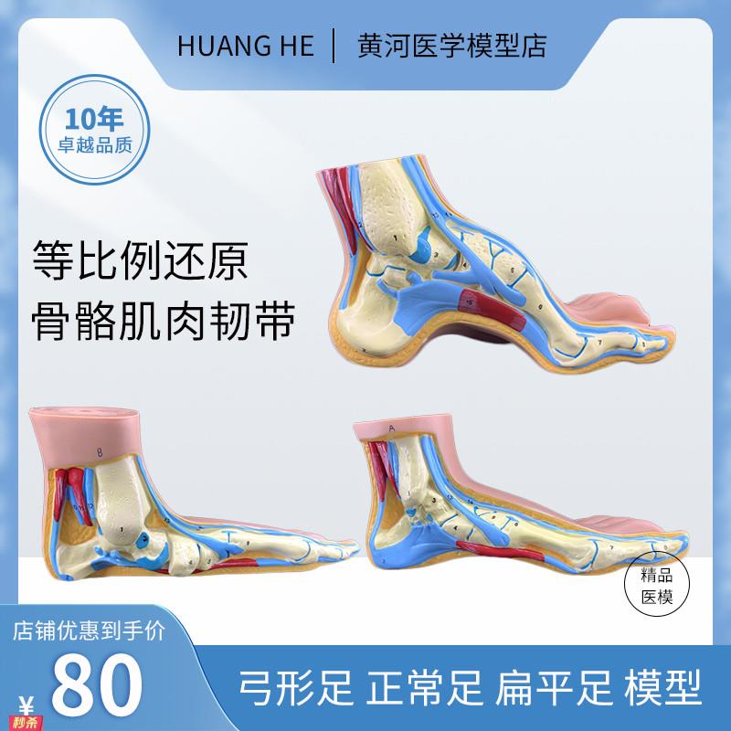 正常足弓形足高弓足模型脚关节模型爪形足脚部模型解剖医院