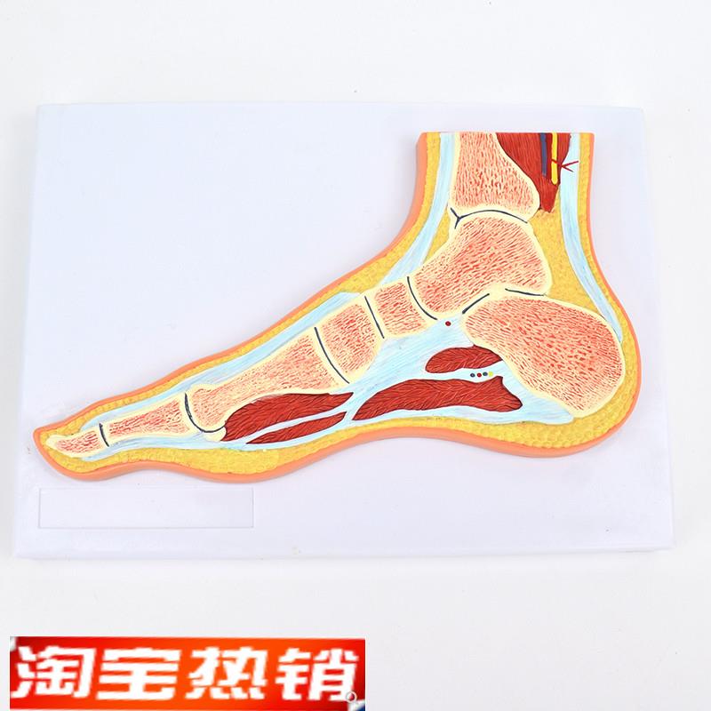 ENOVO颐诺医学足关节骨骼肌肉模型踝关节脚关节构造MRZI骨科教学
