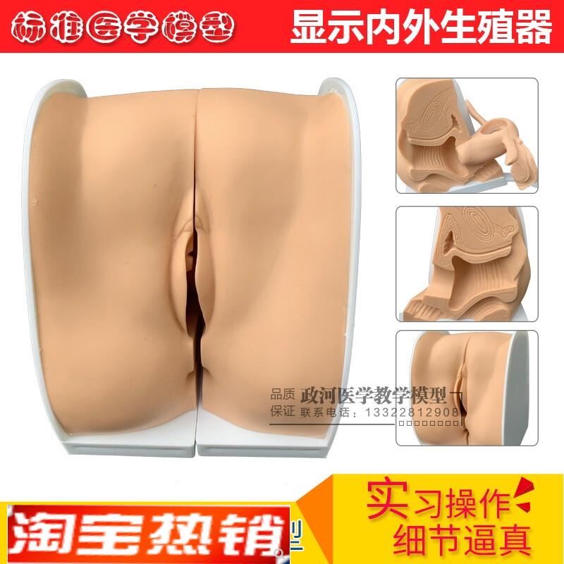 避孕指导模型/女性避孕模型/计划生育专用/妇科检查模型Z/教学培