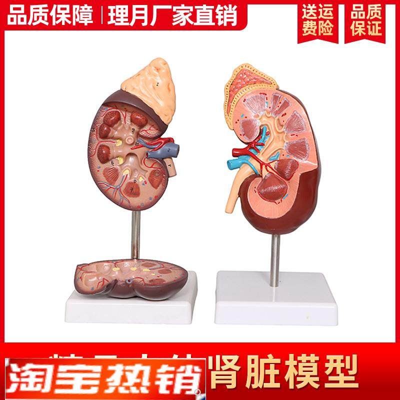 肾解剖模型标准人体肾脏肾u上腺放大模型病变肾脏内脏器官医学教