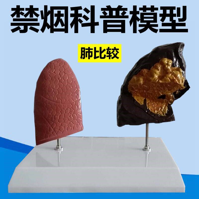 肺模型正常与病理吸烟人的肺禁烟C教育模具公共卫生医学控烟呼吸