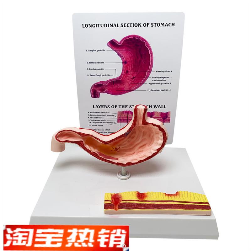 胃解剖模c型胃腹腔病态解剖模型结构人体教学教具人体解剖