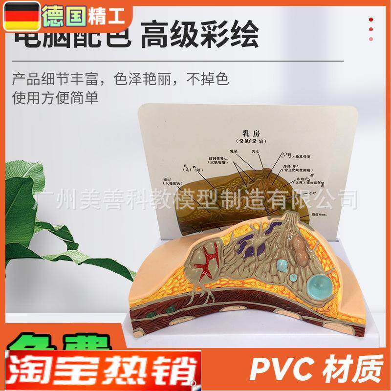 病理乳房模型乳房病变模t型乳房解剖模型乳房常见疾病乳房模型