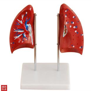 肺解剖模型/肺部模型p二件/人体模型/美术学院专用/教学示范