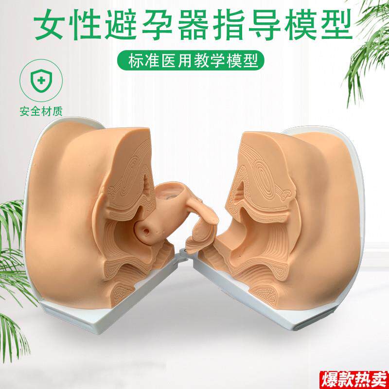 女性避孕器指导模型避孕模型女性内外生殖模型m妇产科教学模型