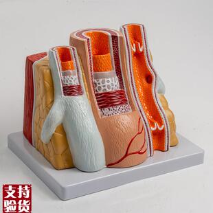 人体血管模型动脉管结构静脉瓣血液循环系统冠状T粥样脂肪沉积阻