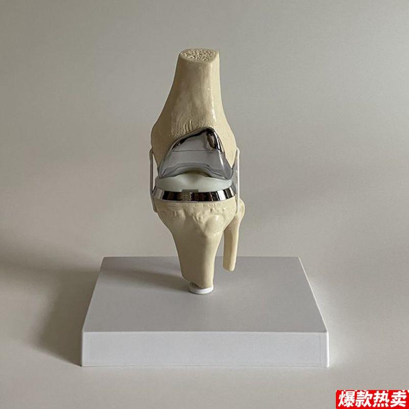 康泰膝关节手术演示A全膝关节假体膝关节置换单髁置换病理半月板