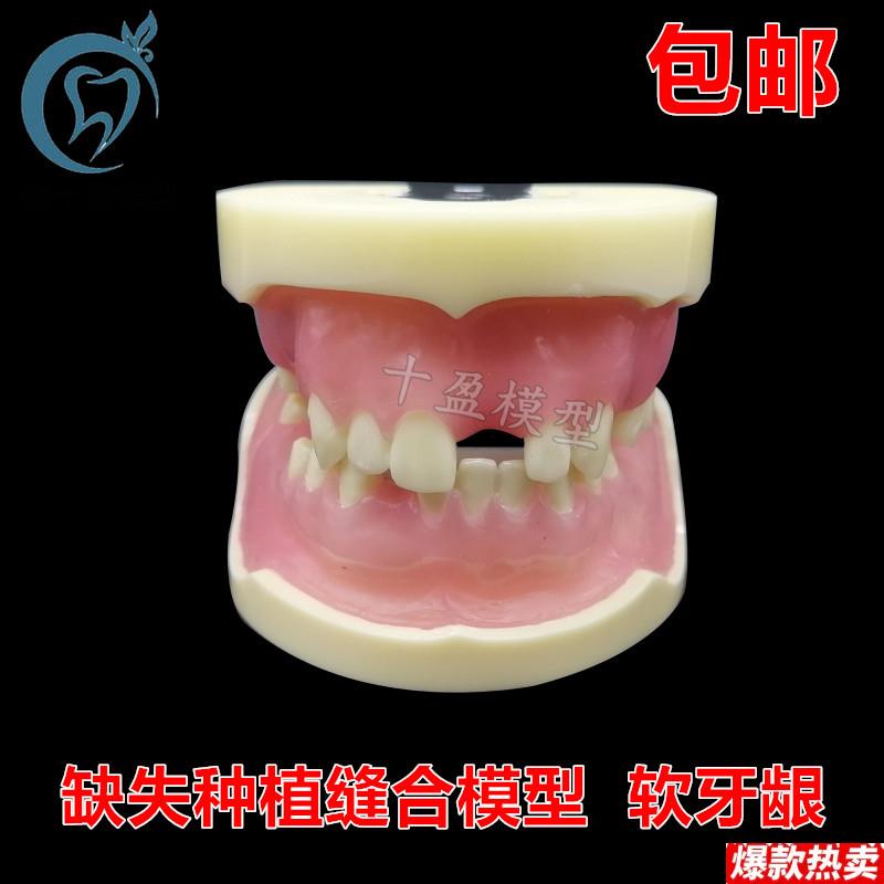 牙科缺失种植模型缝合n练习牙模仿骨质牙齿上颌窦提升术m2002