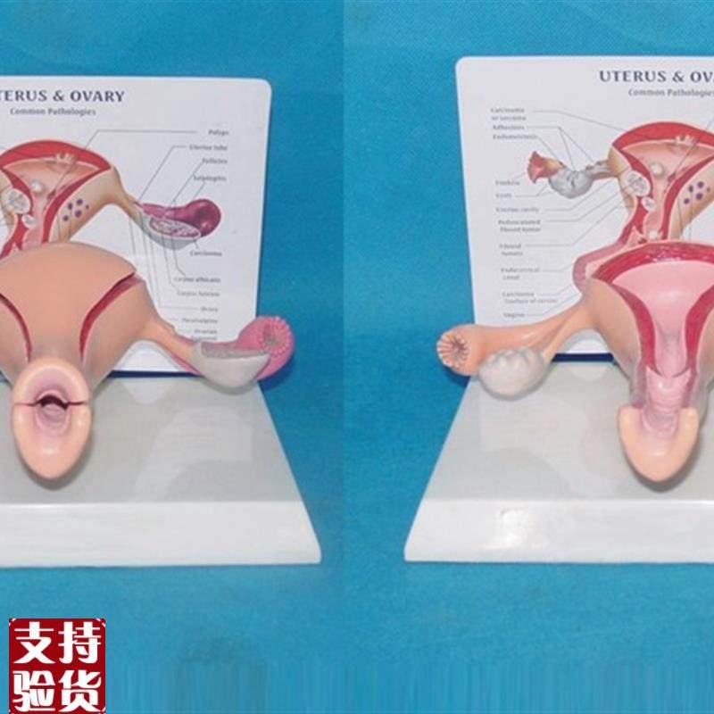 包邮子宫卵巢(健康)模x型生殖器解剖计生医用教学讲解,玩具/童车/益智/积木/模型,其他模型玩具,淘宝优惠券,粉丝福利购,淘宝优惠卷