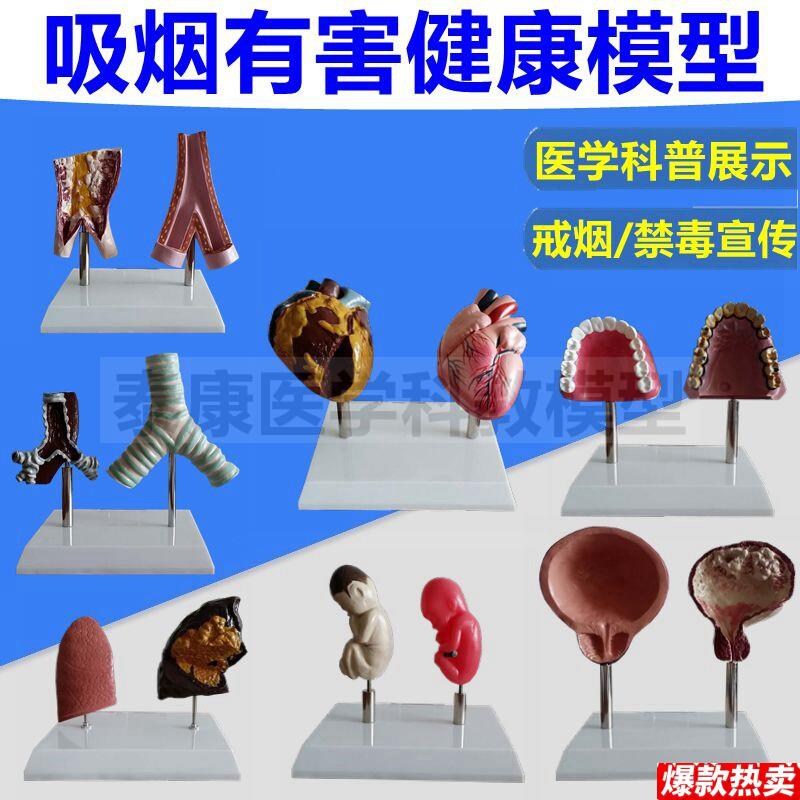 戒烟教育模型吸烟有害健康人体器官受损心脏血管O肺气管膀胱牙齿