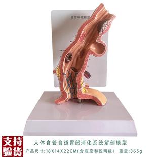 人体食管食道胃部消化系统解剖模型教学内脏解剖R人体教具厂家直