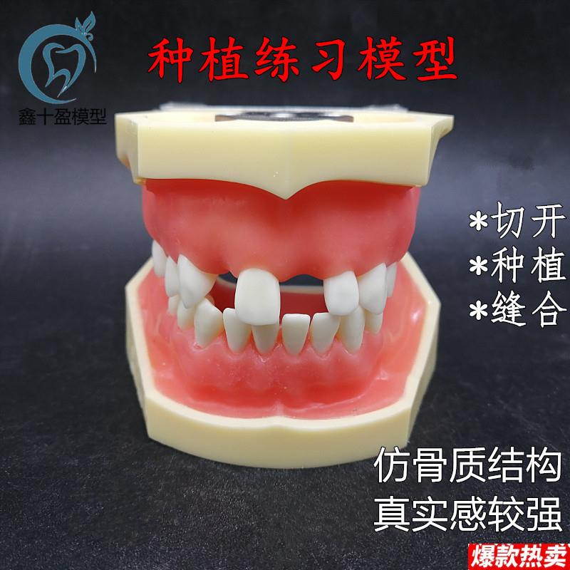 牙科种植上下缺失练习切开种植缝合仿骨V质牙齿模型上颌窦提升术