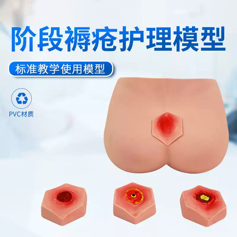 阶段褥疮护理模型m护理操作不同阶段四个临床分期成人臀部模型