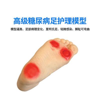 医博BIX-fHS19 糖尿病足护理模型 足部病理展示示教模型教具