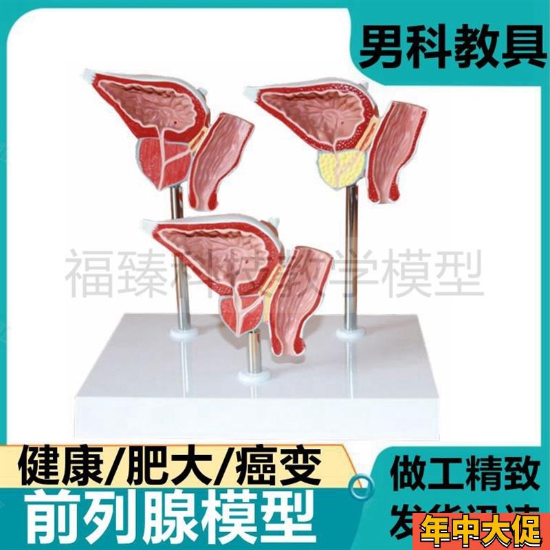 前列腺模型 男科生殖泌尿系统尿道医患医药礼O品膀胱解剖模型3倍