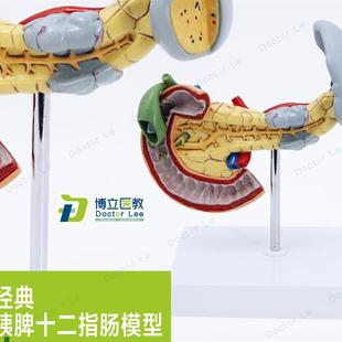 消化胰脏病变胰脾胆十二指肠模A型进口模型人体病变内脏解剖模型