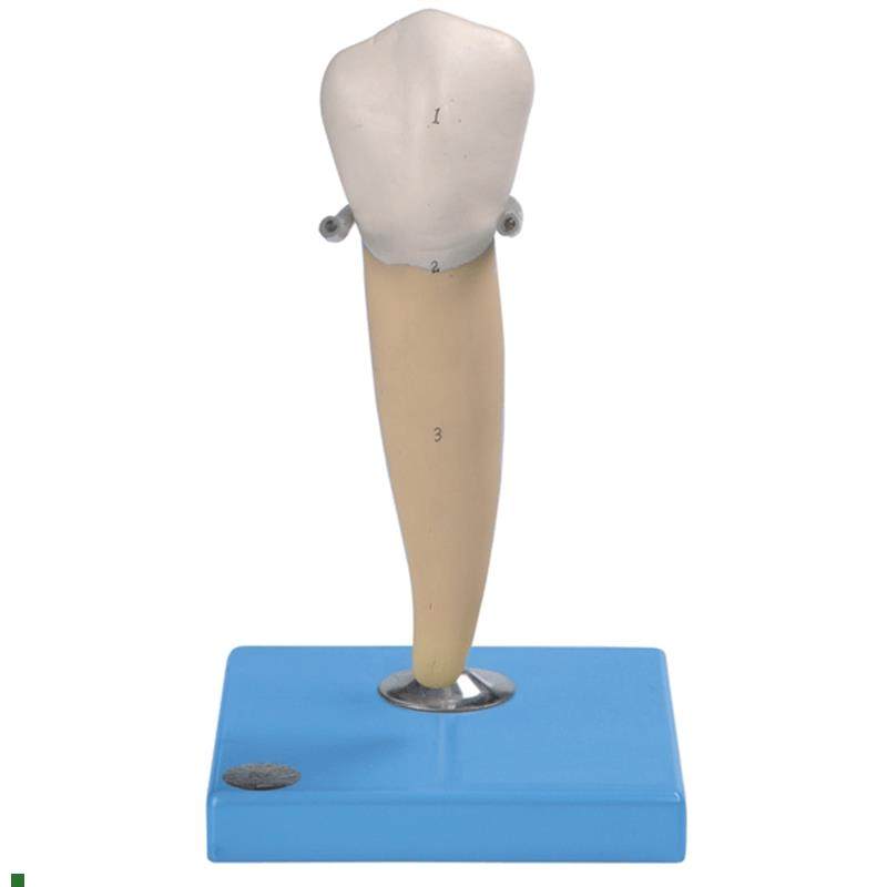 前磨牙有一个牙根v模型B10004/3