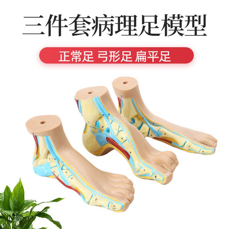正常足 扁d平足 弓型足 模型 足部病理模型人体足部解剖模型脚关