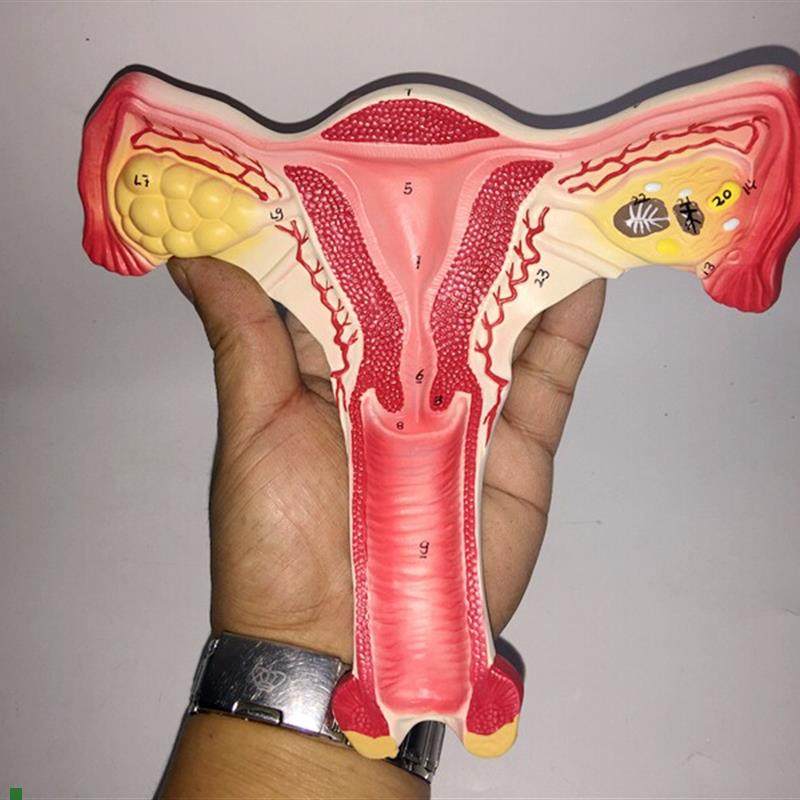 人体模型女性生殖k子宫模型生殖卵巢模型教学模具病理变化科学教