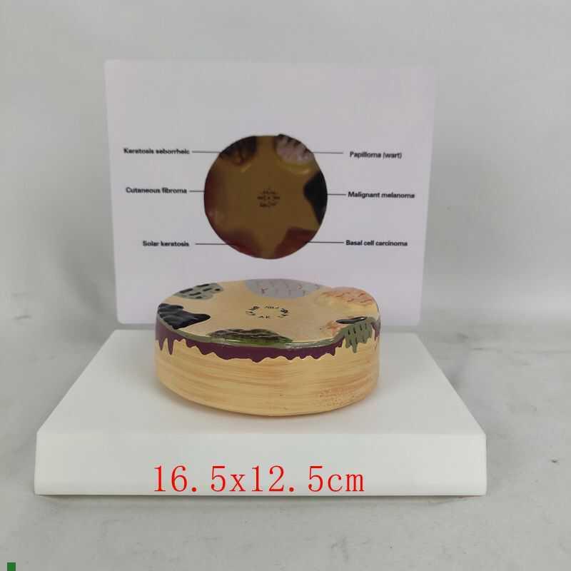 人体病理皮肤演示模型表皮皮肤解剖模型O皮肤科教具教学演示