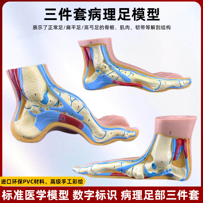 仿真人体脚足部解剖模型正常病变足扁平足弓型足构结肌Z肉医学教