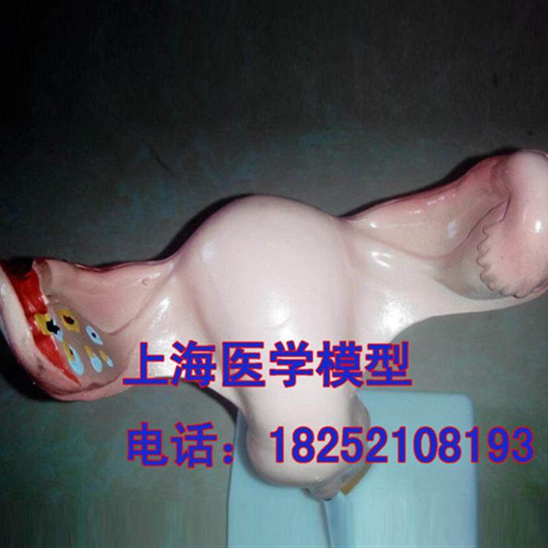 高级子宫放c大模型女性生殖系统解剖模型/人体模型/美院专用