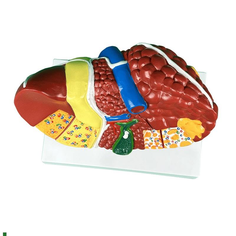 人体肝脏解剖模型肝脏结构模型仿真肝J胆胰脾肾心脏血管内科学