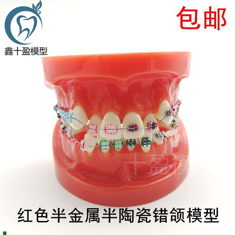 牙科材料正c畸矫正模型医患沟通教学模型牙齿结扎练习模型包邮