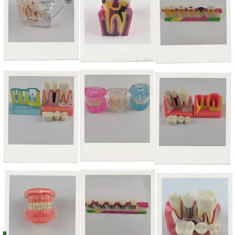 口腔牙齿c教学模型牙模正畸修复种植牙模型准牙模可拆病理医患沟