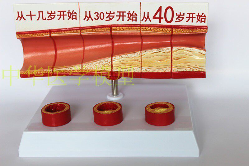 血管 人体血管解剖模型 各阶段年龄层血管展示模型 Y大型血管展示