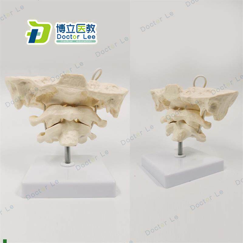 后枕骨颈椎带颈动脉椎间盘与神经教学模型T腰椎骨骼架模型