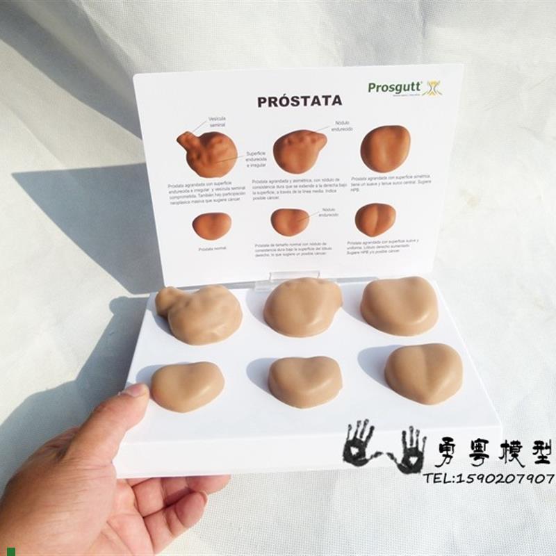 男性前列腺模型病症前p列腺模型人体模型生殖泌尿系统男科教学