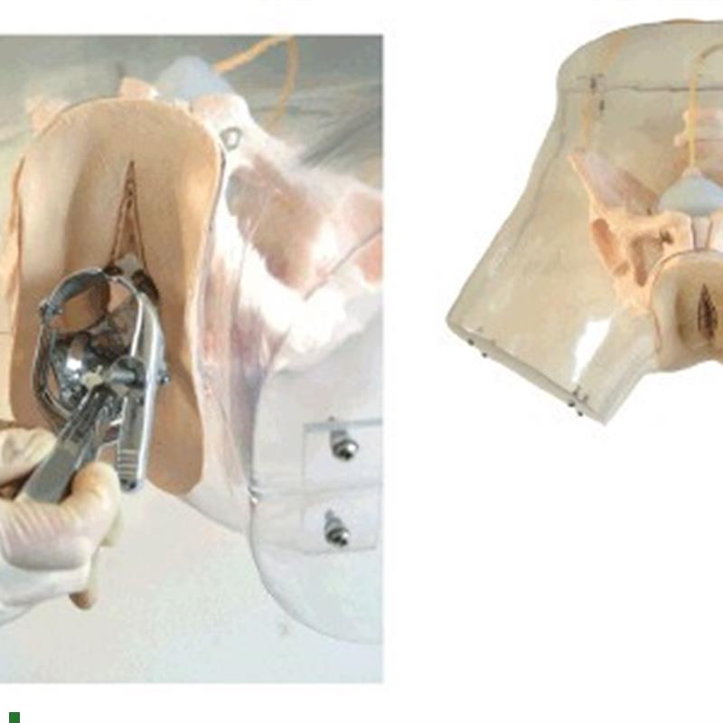 高级透明刮宫模型