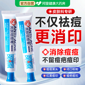 祛痘膏修复淡化痘印草本去痘青春痘红黑痘印痘疤痘坑闭口粉刺凝胶