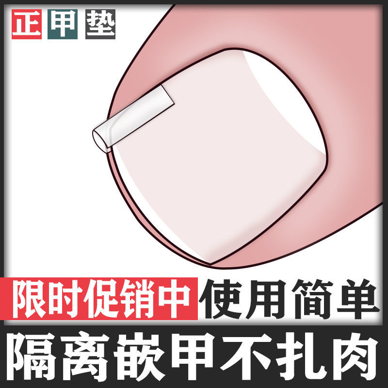 正甲垫矫正嵌甲不再扎肉