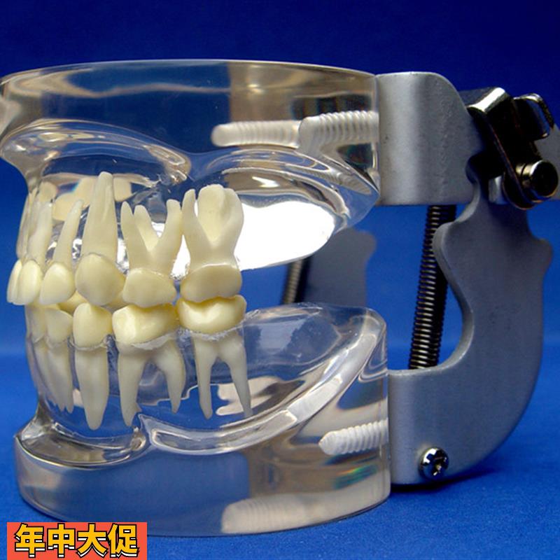 ENOVO颐诺儿童乳牙列模型儿童口腔教学展示模型牙科牙齿模型口腔