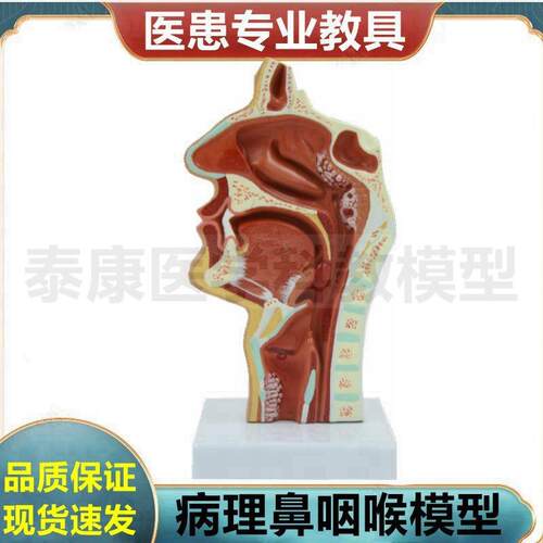 鼻腔模型口腔咽部扁桃体舌咽气管食管声襞病理医患沟通鼻甲鼻道