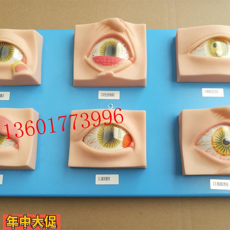 人体常见眼病模型常用眼科疾病模具眼病模型20种常见眼球病变模型