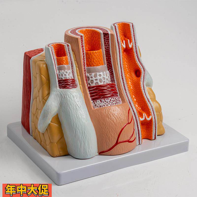 人体血管模型动脉管结构静脉瓣血液循环系统冠状粥样脂肪沉积阻塞