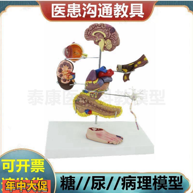 糖尿模型病理器官脑眼睛心血管足肾脏心脏结构病理粥样冠状阻塞