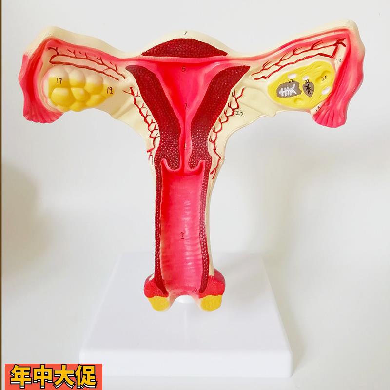 子宫模型生殖器女性器官解剖人体教学教仪医用教具包邮厂家直销